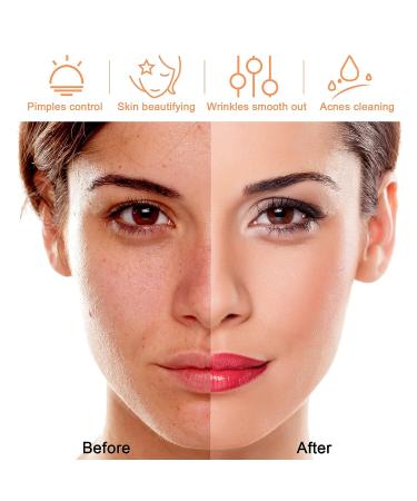 Beauty Star Portable Handheld Skin Care Device for Face and Hair - Daily Use - Buy Online on SooperMarket.com