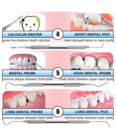 Dental Hygiene Oral Care Kit - Professional Teeth Cleaning Tools | Stainless Steel Dental Tools for Plaque and Tartar Removal | Includes Plaque Remover, Tartar Scraper, Tooth Scaler, Dental Pick - Sea Blue - Buy Online on SooperMarket.com