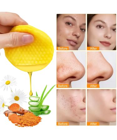Turmeric Kojic Cleansing Pads - 60 Pack | Natural Face & Body Cleansing for Balanced Skin - Buy Online on SooperMarket.com