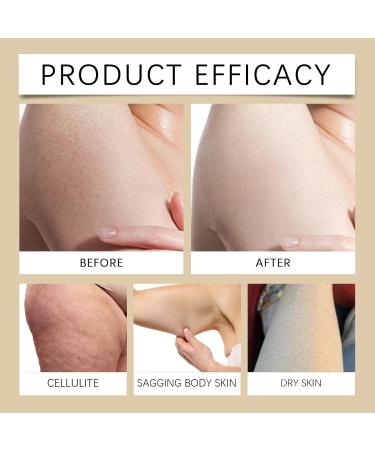 Retinol Anti Cellulite Cream Anti Cellulite Body Stick Hydrating Moisturiser with Hyaluronic Acid & Nicotinamide Natural Firming Body Cream for Tightening Skin Abdomen Legs Arms Buttocks - Buy Online on SooperMarket.com
