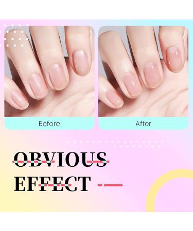 AIJIMEI 4-in-1 Professional Nail Kit: Cuticle Remover Gel Calcium Primer Nail Hardener & Strengthener Base & Top Coat Cuticle Oil - Ultimate Nail Care Solution - Buy Online on SooperMarket.com