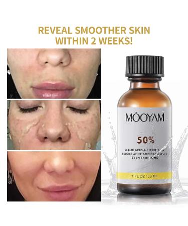 50% Citric Acid Peeling Serum for Face | Skin Peel Solution for Dark Spots & Acne | Exfoliating Chemical Peel 30ml - Buy Online on SooperMarket.com
