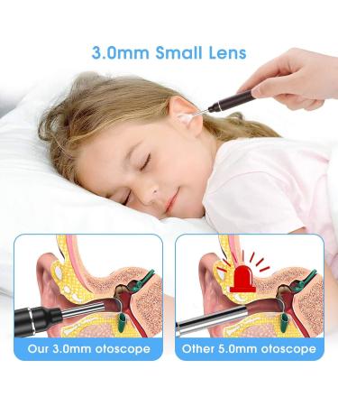 Earwax Remover Tool MYPIN 1080P HD Wireless Otoscope Ear Cleaner Kit Ear Wax Removal Kit Camera Ear Drops for Wax Ear Camera for iPhone/iPad/Android Red - Buy Online on SooperMarket.com