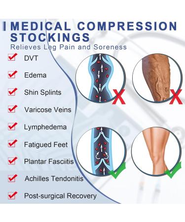 Medical Compression Stockings for Men & Women | Thigh Support 20-30 mmHg for Varicose Veins & Edema Beer Beige Klein - Buy Online on SooperMarket.com