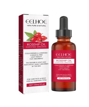 Organic hagebet oil organic facial oil cold-pressed rosehip oil for the skin 30 ml of ethereal facial oil moisturizing body massage oil for scars stretch strips hair nail IDEZEK