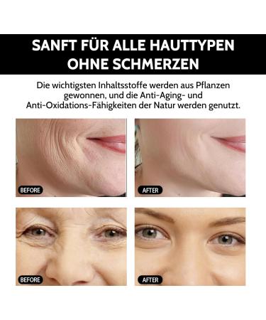 Face Serum for Women Men Vitamin C Serum Instant Face Lift Eye Serum Anti-Ageing Face Cream for Firmer Skin Eye Bags Removal Dark Circles Wrinkle Remover - Buy Online on SooperMarket.com