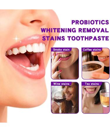 SP-7 Probiotic Whitening Toothpaste - Advanced Whitening & Oral Health (1 Pcs) - International Shipping Available - Buy Online on SooperMarket.com