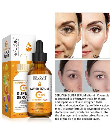 20% Vitamin C Serum for Face with Hyaluronic Acid - Anti-Aging Facial Serum for Men & Women Fades Dark Spots Boosts Collagen Hydrates & Plumps Skin - 1 Fl Oz - Buy Online on SooperMarket.com