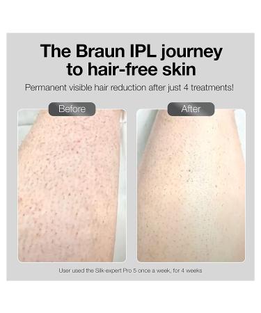 Braun Silk Expert Pro 3 PL3221 IPL Hair Removal System for Women and Men | FDA Cleared for Body & Face | Head-to-Toe Usage | Includes 3 Extra Caps - Buy Online on SooperMarket.com
