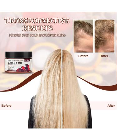 Hair Oil for Men & Women | Batana Oil for Hair Growth | Organic Nourishing & Moisturizing Formula for Thicker & Smoother Hair (4.05 Fl Oz - Buy Online on SooperMarket.com