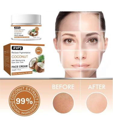 Coconut Face Cream | 24-Hour Moisturising & Revitalising | Reduce Pigmentation & Even Skin Tone | 50g - Shop Internationally - Buy Online on SooperMarket.com