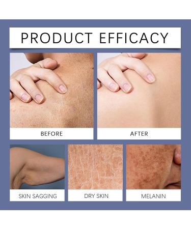 Collagen Lift Body Cream Collagen Firming Body Cream Skin Tightening Cream Collagen Moisturizer Natural Body Lotion Body Moisturizers Lifts Firms & Tightens For Younger Looking Skin 30g - Buy Online on SooperMarket.com