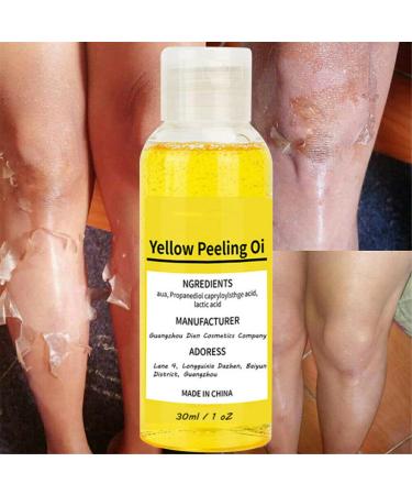 Super Strength Yellow Peeling Oil for Dark Skin - 30/50ml Exfoliating Lightening Treatment - Extra Strength for All Skin Types - Buy Online on SooperMarket.com