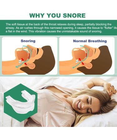 KMIIMET Anti-Snoring Mouthpiece - Comfortable Mouth Guard for Men/Women - Snoring Solution for a Better Night's Sleep - Buy Online on SooperMarket.com
