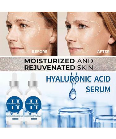 Trendyfave Hyaluronic Acid Serum Serums Skincare Moisturiser Face Women For Anti Aging Firming And Plumping Of Skin Fine Lines Deep Wrinkle Filler Brightening Serum Hydrating Serum With Glycerin - Buy Online on SooperMarket.com