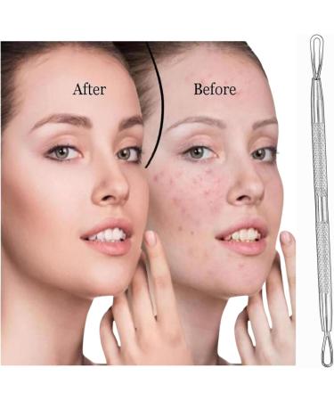 Glamified Blackhead Remover Professional Skincare Spot Treatment Blackhead Remover Tool for Blemish Comedone Whiteheads Pimple Popper with Double Sided Soft Touch and Anti-Slip Design - Buy Online on SooperMarket.com