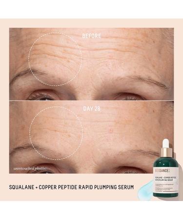 Biossance Instant Hydration Set: Full-Size Squalane + Copper Peptide Serum with Mini Eye Cream & Omega Repair Cream - 1.69 Fl Oz - Buy Online on SooperMarket.com