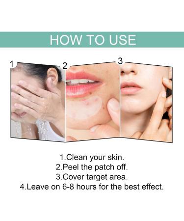 Gentle Solution for Stain Removal | 132 Pimple Spot Treatment for Smooth Skin - Buy Online on SooperMarket.com