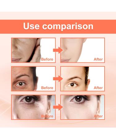 Advanced Deep Anti-Wrinkle Serum Pore Shrink Face Serum Hyaluronic Acid Moisturizing Nourish Essence Collagen Boost Anti-aging Serum - Buy Online on SooperMarket.com