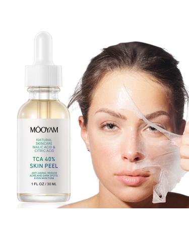40% Citric Acid Peeling Serum  Chemical Peel for Face  Peeling Solution Skin Peel  Chemical Exfoliant for Face  Exfoliating Facial Peel for Dark Skin  Dark Spots  Acne Spot - 30ml/1 Fl oz