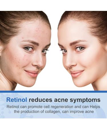 Retinol Face Cream Anti Wrinkle Face Cream Anti Aging Face Cream with 2.5% Retinol Hyaluronic Acid Vitamin E Night Face Cream for Women and Men - Buy Online on SooperMarket.com