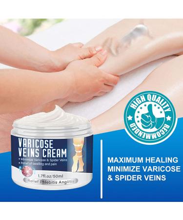 Varicose Veins Cream - Natural Treatment for Legs, Improve Blood Circulation, Strengthen Capillaries & Relieve Tired Legs - Buy Online on SooperMarket.com