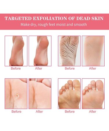 5-Pack Peach Foot Mask for Soft Callus and Dead Skin Removal - Exfoliating Socks for Dry Rough Heels Treatment - Natural Beauty Feet Mask - Buy Online on SooperMarket.com