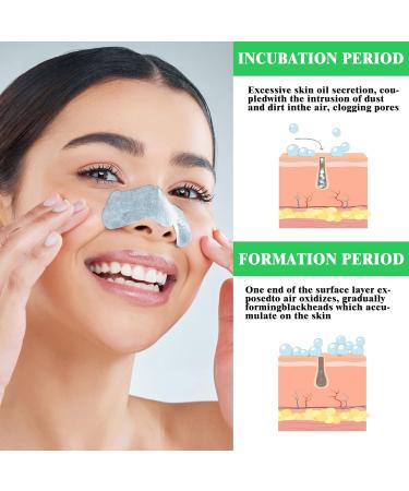 80 Pcs Nose Strips Pore Blackhead Remover Strips Nose Charcoal Bamboo Deep Cleansing of Blackheads Remover to All Skin Types Nose Blackhead Removal Skin Care at Home for Women Men(Black) - Buy Online on SooperMarket.com