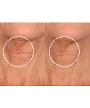 SiO Beauty NeckLift | Overnight Anti-Wrinkle Silicone Patches | Smooth Neck Wrinkles and Fine Lines - Buy Online on SooperMarket.com