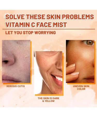 Vitamin C Face Mist VC Skin Brightening Facial Spray Skin Barrier Repair Improve Uneven Skin Relieves Dark Spots Spray Moisturiser VC Hydrating Serum Spray Deeply Moisturizing - Buy Online on SooperMarket.com