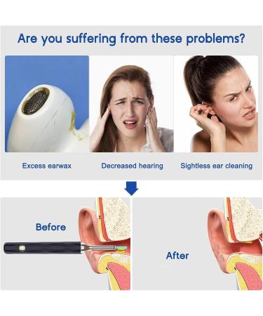 Wireless Ear Wax Removal Tool with Camera and Light - WiFi Enabled, Compatible with iPhone, iPad, Android - Includes 4 Earmuffs - Buy Online on SooperMarket.com