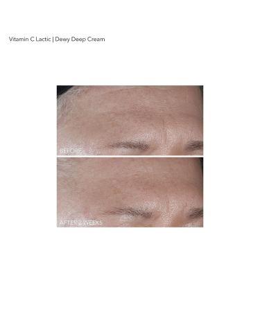 Dr Dennis Gross Vitamin C Lactic Dewy Deep Cream - Ultra-Rich Replenishing 2 oz - Buy Online on SooperMarket.com