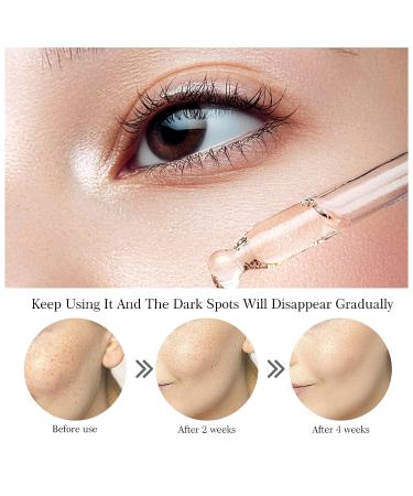 Kojic Acid & Turmeric Dark Spot Corrector Serum | Brightening Face & Body | Sun Spot Remover - 30ml - Buy Online on SooperMarket.com