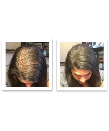 Dark Brown Hair Loss Concealer Trial Size - Cover Bald Spots Instantly - 10-Day Supply - All-Natural Fiber Formula - Buy Online on SooperMarket.com