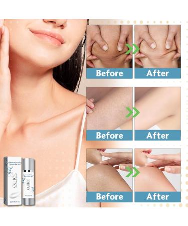 Collagen Lift Body Cream Collagen Skin Tightening Cream Firming Body Cream Collagen Moisturizer Body Moisturizer Skin Tightening Cream For Body Firms & Tightens For Younger Looking Skin 30g - Buy Online on SooperMarket.com