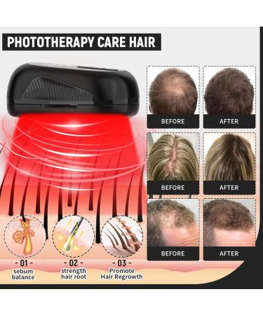 Laser Comb Hair Growth Device Medical Grade Lasers FDA Cleared Hair Loss Treatment for Men and Women with Thinning Hair Rechargeable Hair Growth Product Black - Buy Online on SooperMarket.com