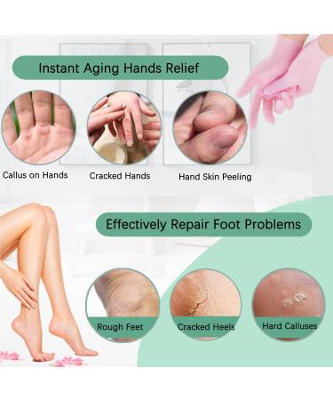 Silicone Socks for Cracked Feet - Moisturizing Gel & Aloe Foot Care Set for Women - Buy Online on SooperMarket.com