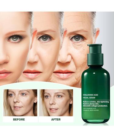 Hyaluronic Acid Facial Serum Hyaluronic Acid Serum Anti Wrinkle Serum Dark Spot Remover for Face Hyaluronic Acid Face Serum for Women Face Moisturiser Skin Tightening Hydrating Plump Skin - Buy Online on SooperMarket.com