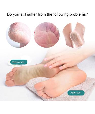 Glass Foot File Callus Remover Clear Glass Foot File Pedicure Helper - Pedicure Foot Buffer in Shower Foot Scrubber for Removes Dead Skin Egg - Buy Online on SooperMarket.com