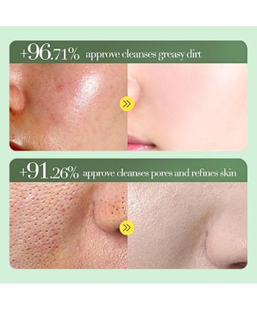 Acne Foaming Wash Acne Face Wash Gentle Face Wash for Acne Prone Skin Anti-Acne Facial Wash for Deep Pore Cleansing Tea Tree Oil Facial Cleanser with Hyaluronic Acid Deep Hydration - Buy Online on SooperMarket.com