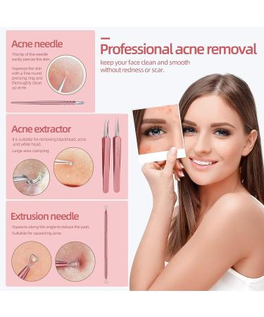 JPNK Blackhead & Acne Removal Kit with Mirror Tweezer - Blemish Extractor Tools Set - Buy Online on SooperMarket.com