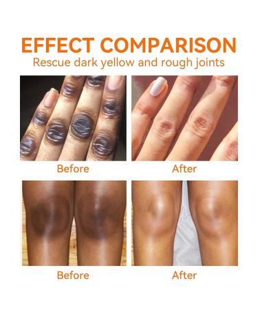 Dark Spot Corrector Cream - Underarm Knee Elbow & Intimate Skin Treatment - 4.21oz - Buy Online on SooperMarket.com