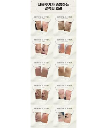 Hydrogen Dual Skin Changer Set | Hydrating Anti-Aging K-Beauty Therapy | International Shipping - Buy Online on SooperMarket.com
