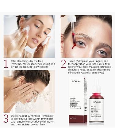 AHA 30% + BHA 2% Peeling Solution - Anti-Acne Serum & Chemical Peel for Face | BHA Liquid Exfoliant for Blemishes & Wrinkles - 1 Floz - Buy Online on SooperMarket.com