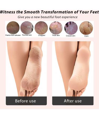 ICDI ICANdOIT Natural Bamboo Foot File Callus Remover - 4 in 1 Feet Pedicure Kit with Bristle Brush, Pumice Stone, Foot Rasp & Sand Paper - Foot Care Essential - Buy Online on SooperMarket.com