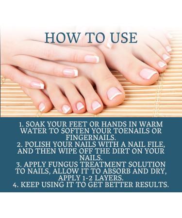 Fungal Nail Treatment - Extra Strong Nail Fungus Treatment for Toenail and Fingernail - Fungal Nail Eliminator Anti fungus Nail Repair and Strengthen Fix & Renew Damaged Broken Nails 30ml - Buy Online on SooperMarket.com