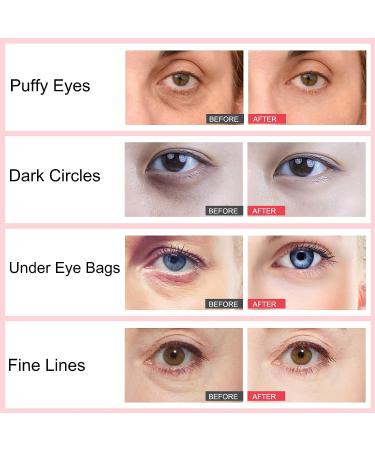 Retinol Eye Stick - Anti Aging Brightening Cream for Dark Circles & Puffiness - Buy Online on SooperMarket.com