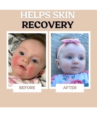 Roe Wellness Baby Cream Lotion Ointment | Moisturizing Biome Barrier Cream for Kids | Clean Ingredients for Dry Skin & Itch Relief - Buy Online on SooperMarket.com