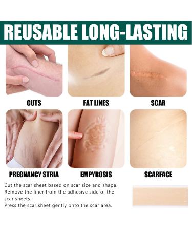 Scar Tape Roll for Burn Scar Removal - Pain-Free & Metabolism-boosting Solution - Buy Online on SooperMarket.com