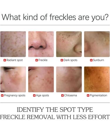 Dark Spot Remover for Face Hyaluronic Acid Dark Spot Correcting Serum Anti Aging Face Serum for Women Nicotinamide Dark Spot Correcting Glow Serum Anti Spot Face Serum and Oil Skin Moisturizer-30ml - Buy Online on SooperMarket.com